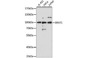 Western blot analysis of extracts of various cell lines, using Brat1 antibody (ABIN6290105) at 1:3000 dilution.