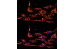 Immunofluorescence analysis of C6 cells using  antibody (ABIN7265422) at dilution of 1:100. (ACOX3 antibody  (AA 10-100))