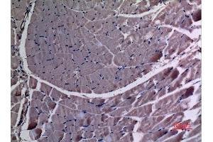 Immunohistochemistry (IHC) image for anti-Ubiquitination Factor E4A (UBE4A) (N-Term) antibody (ABIN3187641)
