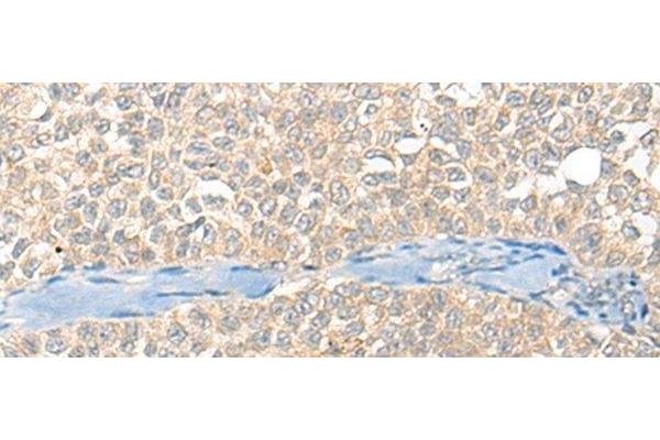 SNX6 antibody