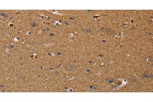 Immunohistochemistry of paraffin-embedded Human brain using DDAH1 Polyclonal Antibody at dilution of 1:50 (DDAH1 antibody)
