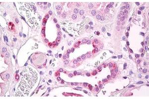 Anti-STRADB / ALS2CR2 antibody IHC staining of human kidney, tubules. (STRADB antibody  (AA 200-250))