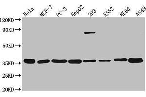 Western Blot Positive WB detected in: Hela whole cell lysate, MCF-7 whole cell lysate, PC-3 whole cell lysate, HepG2 whole cell lysate, 293 whole cell lysate, K562 whole cell lysate, HL60 whole cell lysate, A549 whole cell lysate All lanes: ANXA5 antibody at 1:3000 Secondary Goat polyclonal to rabbit IgG at 1/50000 dilution Predicted band size: 36 kDa Observed band size: 36 kDa (Annexin V antibody  (AA 2-320))