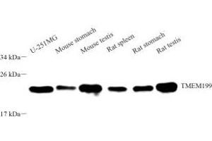 Western blot analysis of TMEM199 (ABIN7075998) at dilution of 1: 2000 (TMEM199 antibody)