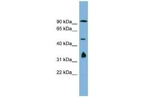 MAK10 antibody used at 1 ug/ml to detect target protein. (MAK10/NAA35 antibody  (N-Term))