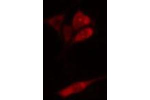 ABIN6274924 staining HepG2 cells by IF/ICC. (BAIAP2L1 antibody  (Internal Region))