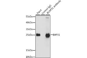 Immunoprecipitation analysis of 200 μg extracts of HeLa cells, using 3 μg B antibody (ABIN6129973, ABIN6137477, ABIN6137478 and ABIN6222845). (BCAP31 antibody  (AA 127-246))