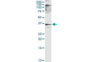 Immunoprecipitation of HMGCL transfected lysate using anti-HMGCL MaxPab rabbit polyclonal antibody and Protein A Magnetic Bead , and immunoblotted with HMGCL MaxPab rabbit polyclonal antibody (D01) . (HMGCL antibody  (AA 1-325))