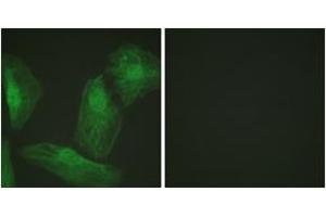 Immunofluorescence analysis of HeLa cells, using Smad2 (Ab-220) Antibody. (SMAD2 antibody  (AA 186-235))