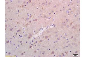 Formalin-fixed and paraffin embedded rat brain labeled with Anti-RHEB Polyclonal Antibody, Unconjugated (ABIN704771) at 1:200 followed by conjugation to the secondary antibody and DAB staining.