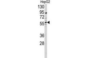 Western Blotting (WB) image for anti-24-Dehydrocholesterol Reductase (DHCR24) antibody (ABIN3001663)