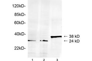 Lane 1: Hela cell lysateLane 2: HEK293 cell lysateLane 3: Recombinant human Geminin proteinWestern blot analysis of cell lysates and recombinant human Geminin protein using 1 µg/mL Rabbit Anti-Geminin Polyclonal Antibody (ABIN398787) The signal was developed with IRDyeTM 800 Conjugated Goat Anti-Rabbit IgG.