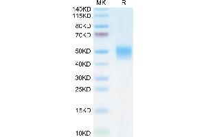 Biotinylated Mouse PD-L1 on Tris-Bis PAGE under reduced condition. (PD-L1 Protein (AA 19-238) (His tag,Biotin))