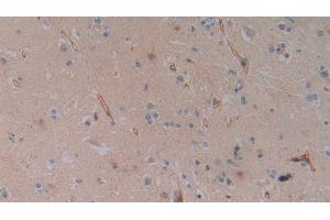 Immunohistochemistry (IHC) image for anti-Solute Carrier Family 9 (Sodium/hydrogen Exchanger), Member 3 Regulator 2 (SLC9A3R2) (AA 56-337) antibody (ABIN7442744)