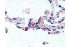 Immunohistochemical (Formalin/PFA-fixed paraffin-embedded sections) staining in human lung (neutrophils) with EMR2 polyclonal antibody . (EMR2 antibody)