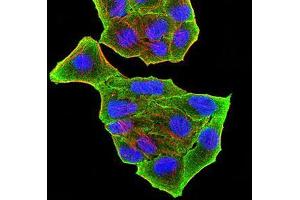 Immunocytochemistry (ICC) image for anti-PR Domain Containing 5 (PRDM5) (AA 1-100) antibody (ABIN5874500) (PRDM5 antibody  (AA 1-100))