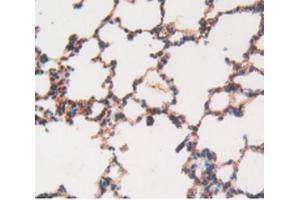 IHC-P analysis of Rat Lung Tissue, with DAB staining. (MMP12 antibody  (AA 20-99))