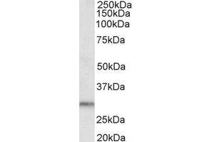 Western Blotting (WB) image for anti-Dual Adaptor of Phosphotyrosine and 3-phosphoinositides (DAPP1) (C-Term) antibody (ABIN2464796)