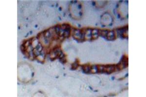 Used in DAB staining on fromalin fixed paraffin-embedded Kidney tissue (nectin-3 antibody  (AA 90-293))