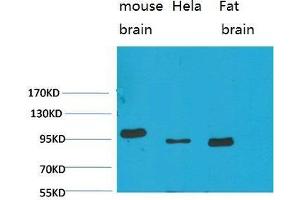 Western Blot (WB) analysis of 1)Mouse Brain Tissue, 2)HeLa, 3)Rat Brain Tissue with EphA1 Rabbit Polyclonal Antibody diluted at 1:2000. (EPHA1 antibody)