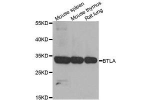Western blot analysis of extracts of various cell lines, using BTLA antibody. (BTLA antibody  (AA 31-241))