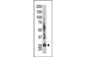 Image no. 1 for anti-Adenylate Kinase 5 (AK5) (N-Term) antibody (ABIN360616) (Adenylate Kinase 5 antibody  (N-Term))