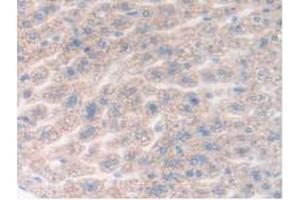 IHC-P analysis of Mouse Liver Tissue, with DAB staining. (DDX58 antibody  (AA 1-211))