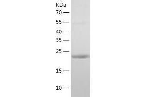 Western Blotting (WB) image for Casein beta (CSN2) (AA 16-226) protein (His tag) (ABIN7122156) (CSN2 Protein (AA 16-226) (His tag))