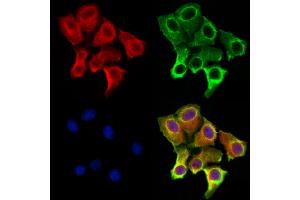 ABIN6262479 and ABIN6273001 staining Hela cells by IF/ICC.