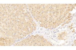 Detection of VEGFB in Human Liver Tissue using Polyclonal Antibody to Vascular Endothelial Growth Factor B (VEGFB) (VEGFB antibody  (AA 22-207))