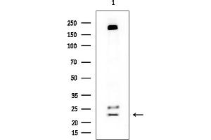 Western blot analysis of lysates from Rat brain, using GUCA1A Mouse Monoclonal Antibody at 1/1000 dilution.