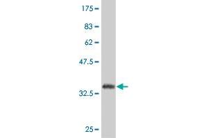 Western Blot detection against Immunogen (36. (SP1 antibody  (AA 522-618))