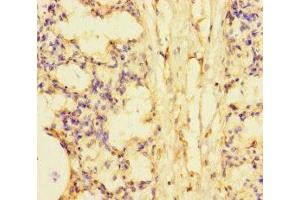 Immunohistochemistry of paraffin-embedded human lung tissue using ABIN7169732 at dilution of 1:100 (SMCO1 antibody  (AA 82-214))