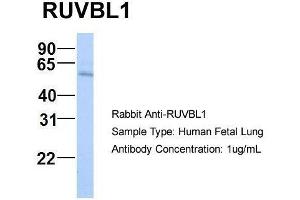 Host:  Rabbit  Target Name:  RUVBL1  Sample Type:  Human Fetal Lung  Antibody Dilution:  1.
