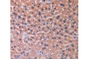 IHC-P analysis of liver tissue, with DAB staining. (IL18RAP antibody  (AA 396-548))