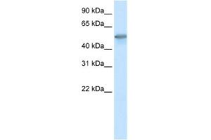 WB Suggested Anti-FOXO3A Antibody Titration:  0. (FOXO3 antibody  (C-Term))