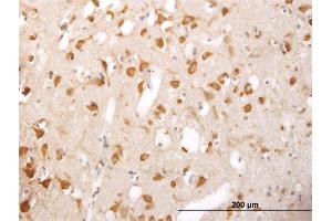Immunoperoxidase of monoclonal antibody to TRIM25 on formalin-fixed paraffin-embedded human cerebral cortex. (TRIM25 antibody  (AA 211-310))