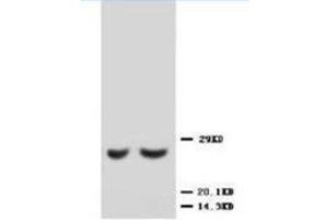 Western blot analysis of rat kidney lysis using TIMP2 antibody (TIMP2 antibody  (C-Term))