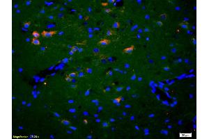 Formalin-fixed and paraffin-embedded rat brain labeled with Anti-EphA2/Eph receptor A2 Polyclonal Antibody, Unconjugated (ABIN669201) 1:200, overnight at 4°C, The secondary antibody was Goat Anti-Rabbit IgG, Cy3 conjugated used at 1:200 dilution for 40 minutes at 37°C. (EPH Receptor A2 antibody  (AA 901-976))