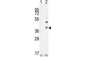 Western blot analysis of TNFSF15 (arrow) using rabbit polyclonal TNFSF15 Antibody (Center) .