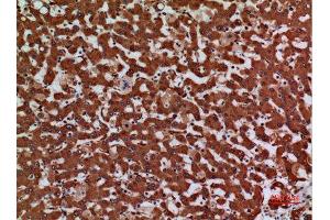 Immunohistochemistry (IHC) analysis of paraffin-embedded Human Liver, antibody was diluted at 1:100.