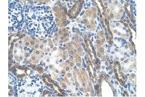 LOC728227 antibody was used for immunohistochemistry at a concentration of 4-8 ug/ml to stain Epithelial cells of renal tubule (arrows) in Human Kidney. (LOC728227 antibody  (C-Term))
