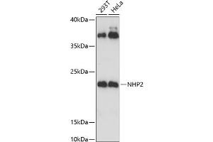 Western blot analysis of extracts of various cell lines, using NHP2 Antibody (ABIN6133224, ABIN6144622, ABIN6144623 and ABIN6221656) at 1:3000 dilution. (NHP2 antibody  (AA 1-153))