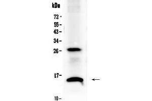 Western blot analysis of SDF1 using anti-SDF1 antibody . (CXCL12 antibody)