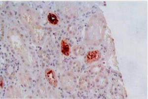 Immunohistochemistry of paraffin-embedded sections (kidney) Immunohistochemistry staining of kidney allograft biopsy (paraffin-embedded sections) with anti-human HLA-G (MEM-G/2). (HLAG antibody)