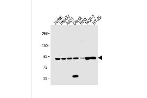 All lanes : Anti-STAT1 Antibody (C-term) at 1:1000 dilution Lane 1: Jurkat whole cell lysate Lane 2: HepG2 whole cell lysate Lane 3: A431 whole cell lysate Lane 4: Daudi whole cell lysate Lane 5: Hela whole cell lysate Lane 5: MCF-7 whole cell lysate Lane 5: HT-29 whole cell lysate Lysates/proteins at 20 μg per lane. (STAT1 antibody  (C-Term))