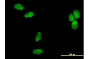 Immunofluorescence (IF) image for anti-Polymerase (DNA Directed), delta 2, Accessory Subunit (POLD2) (AA 1-469) antibody (ABIN519020)