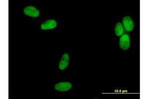 Immunofluorescence of purified MaxPab antibody to POLD2 on HeLa cell. (POLD2 antibody  (AA 1-469))