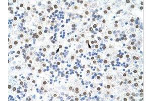 Image no. 1 for anti-Musashi Homolog 2 (MSI2) (AA 37-86) antibody (ABIN203056) (MSI2 antibody  (AA 37-86))