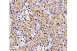 Immunohistochemistry analysis of paraffin-embedded rat kidney using,SLC22A1 (ABIN7075663) at dilution of 1: 1200 (SLC22A1 antibody)